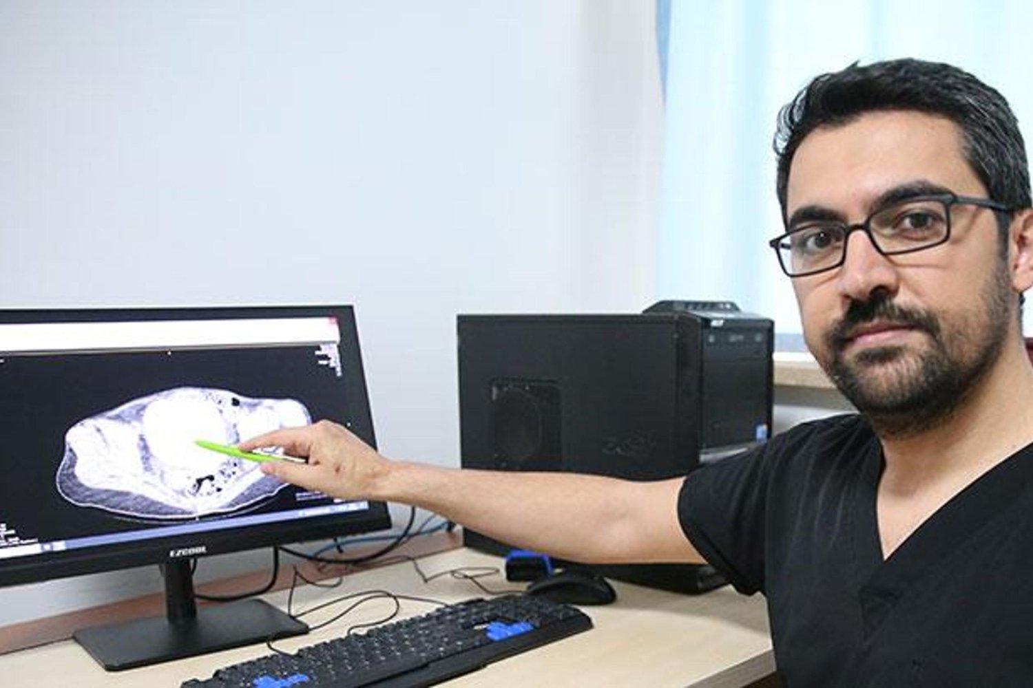 Diyarbakır'da 6 Büyük Böbrek ve Mesane Taşı Operasyonu Şoku