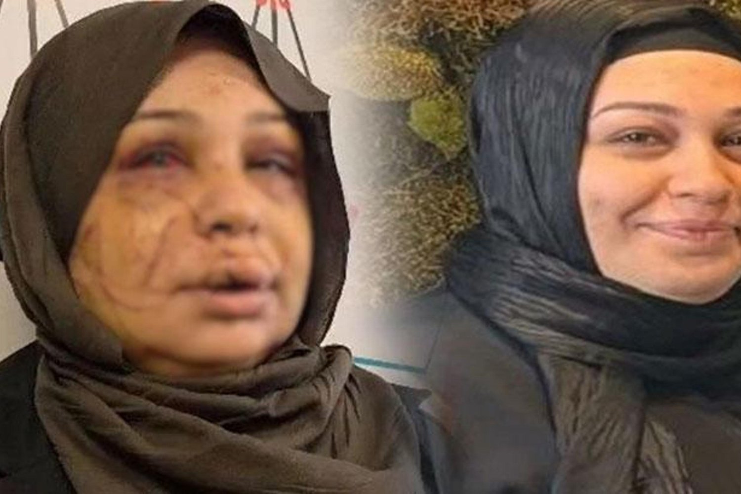 Ankara’da Polis Memuru Eşini Yüzünü Keserek Ağır Yaraladı, Tutuklandı!