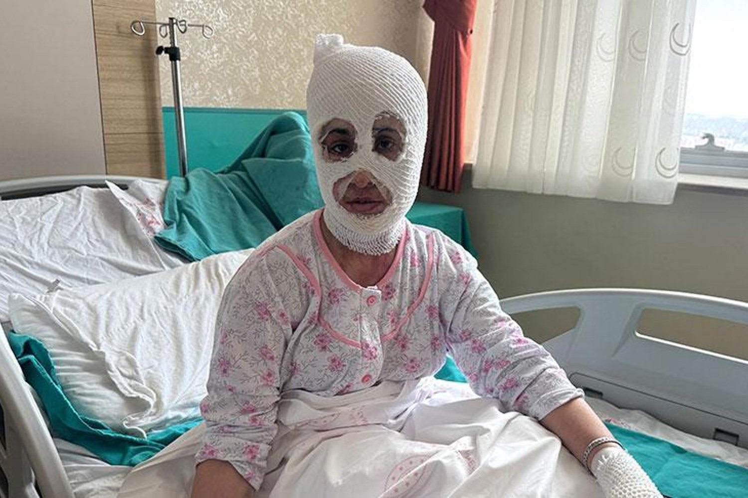 Düdüklü Tencere Patlaması: Yanık ve Yaralanmalara Neden Oldu!