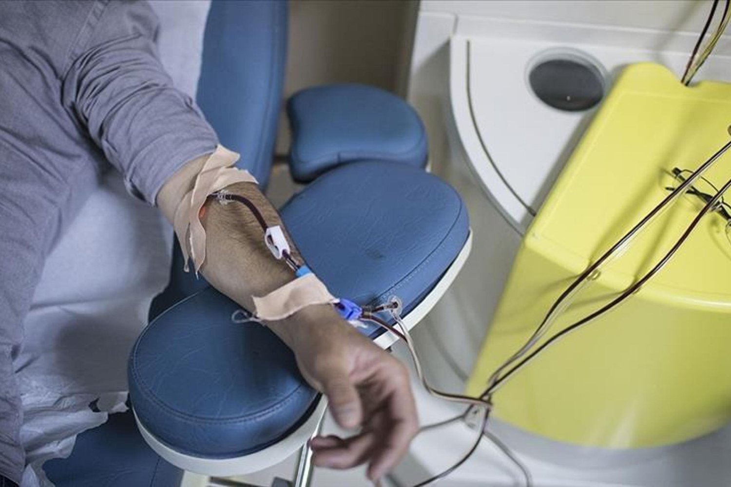 İstanbul'da Günde 11 Bin Hastaya Diyaliz Hizmeti Sunuluyor: Yeni Gelişmeler