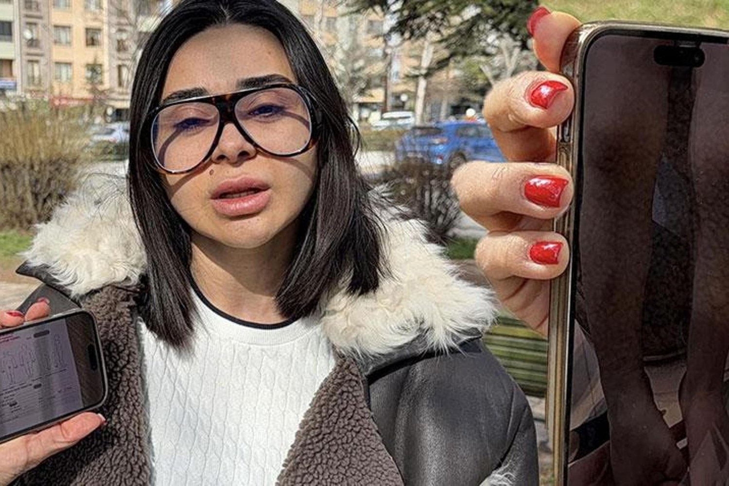 Kreşte Oğlunu Darp Eden Kuruma Dava Açan Anne Şikayetçi Oldu