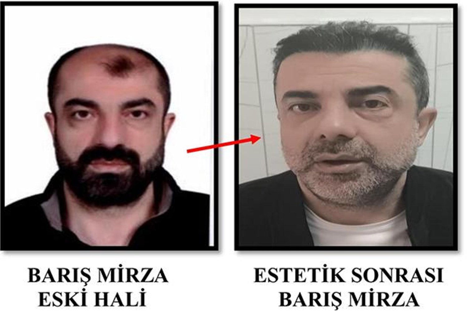 Ankara'da Firari Şüpheli Yakalandı: Yüzünü Değiştirip Kardeş Kimliğiyle Giriş Yapmış