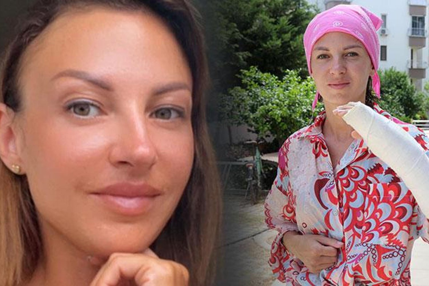 Antalya'da Eş Yaşadığı Şiddetle Şok Etti: 16 Gün Hastanede Mücadele!