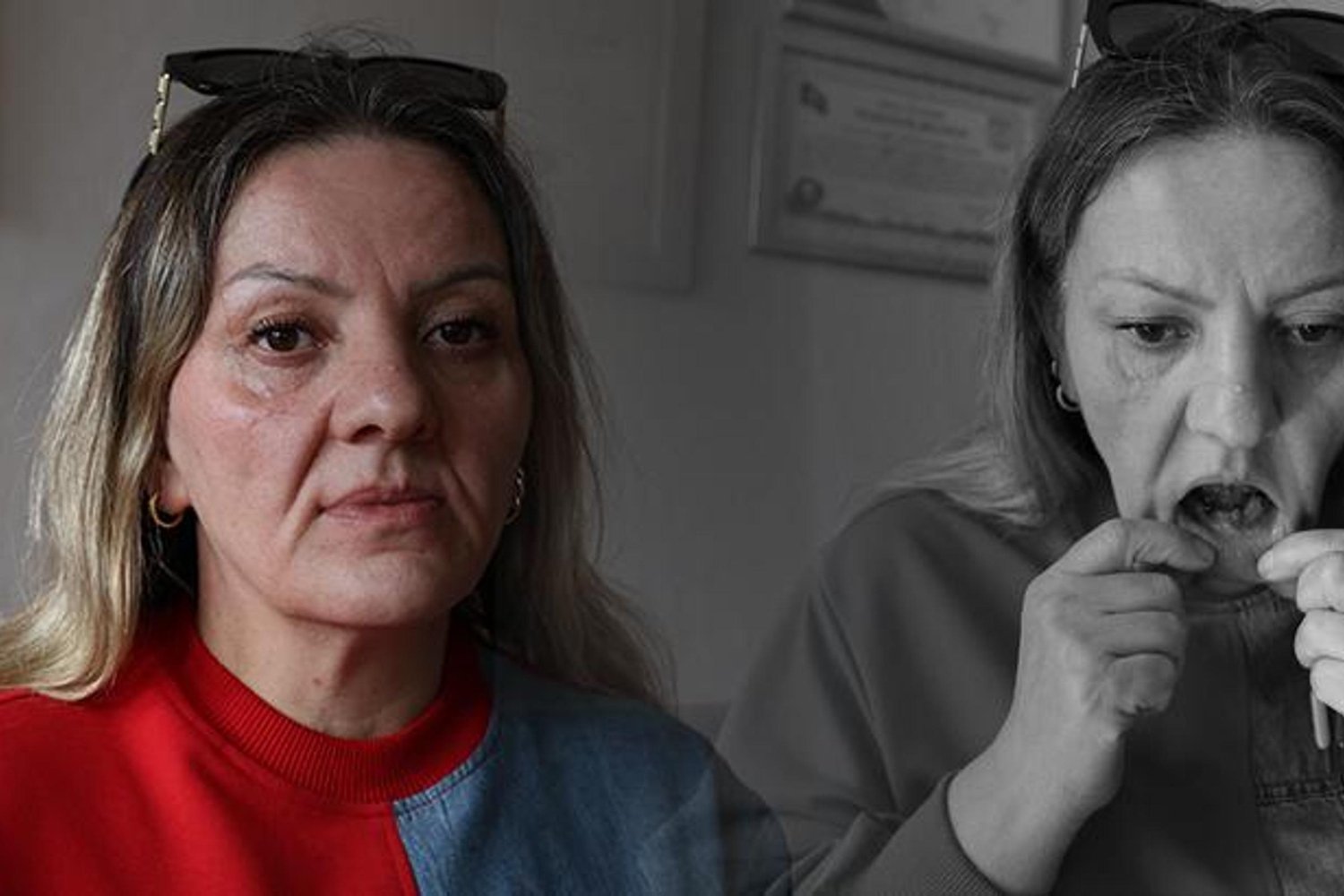 Diş Tedavisinde Facia Yapan Klinik: Gülbeyaz Çelikdemir'in Yaşam Mücadelesi
