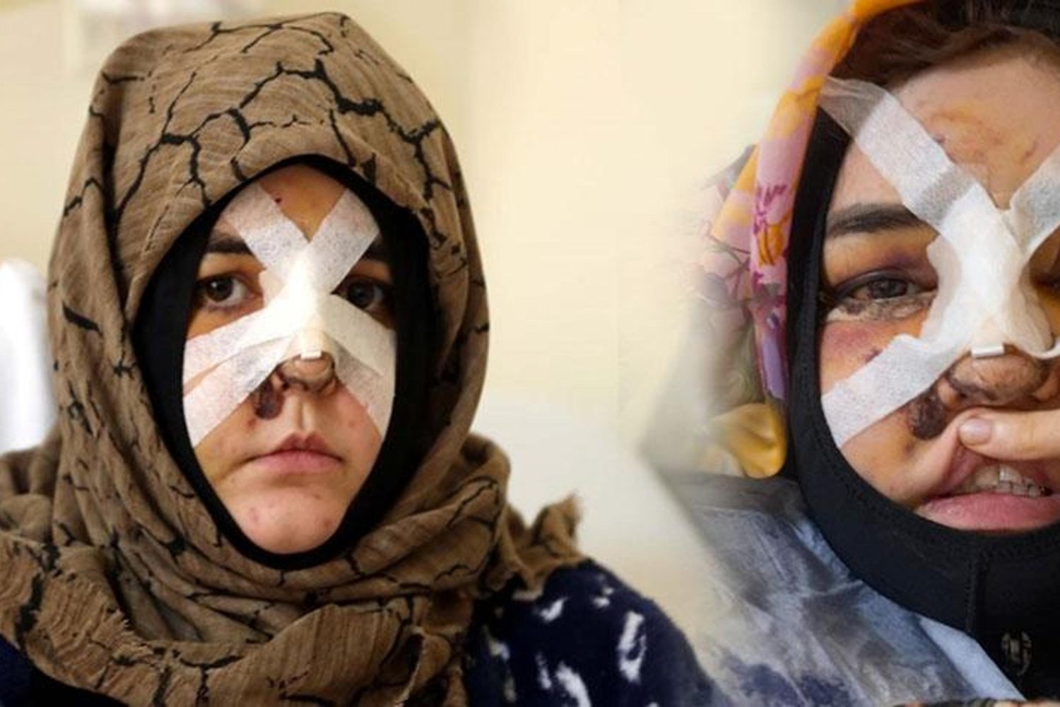 Şiddetli Boşanma Sırasında Kavga: Kaldırım Taşıyla Yaraladı, Tutuklandı