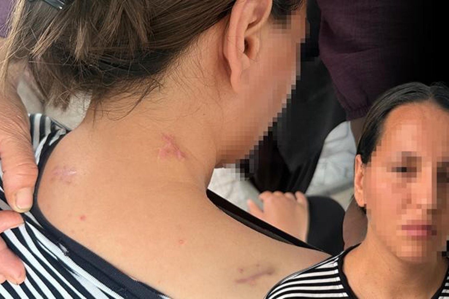 Tarsus'ta Şiddetli Evlilik Krizi: Eşini Bıçaklayan Kadın Ağır Yaralandı