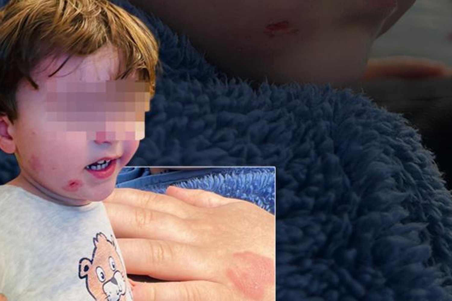 Kreşte Çocuk Darp Olayı Şok Edici Detaylar Feldekte