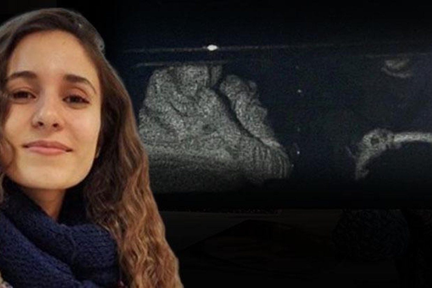 Gülistan Doku Davasında Gözaltına Alınan Gökhan Ertok’un Gizemli Para Transferleri ve Sim Kart İzi Sürülüyor