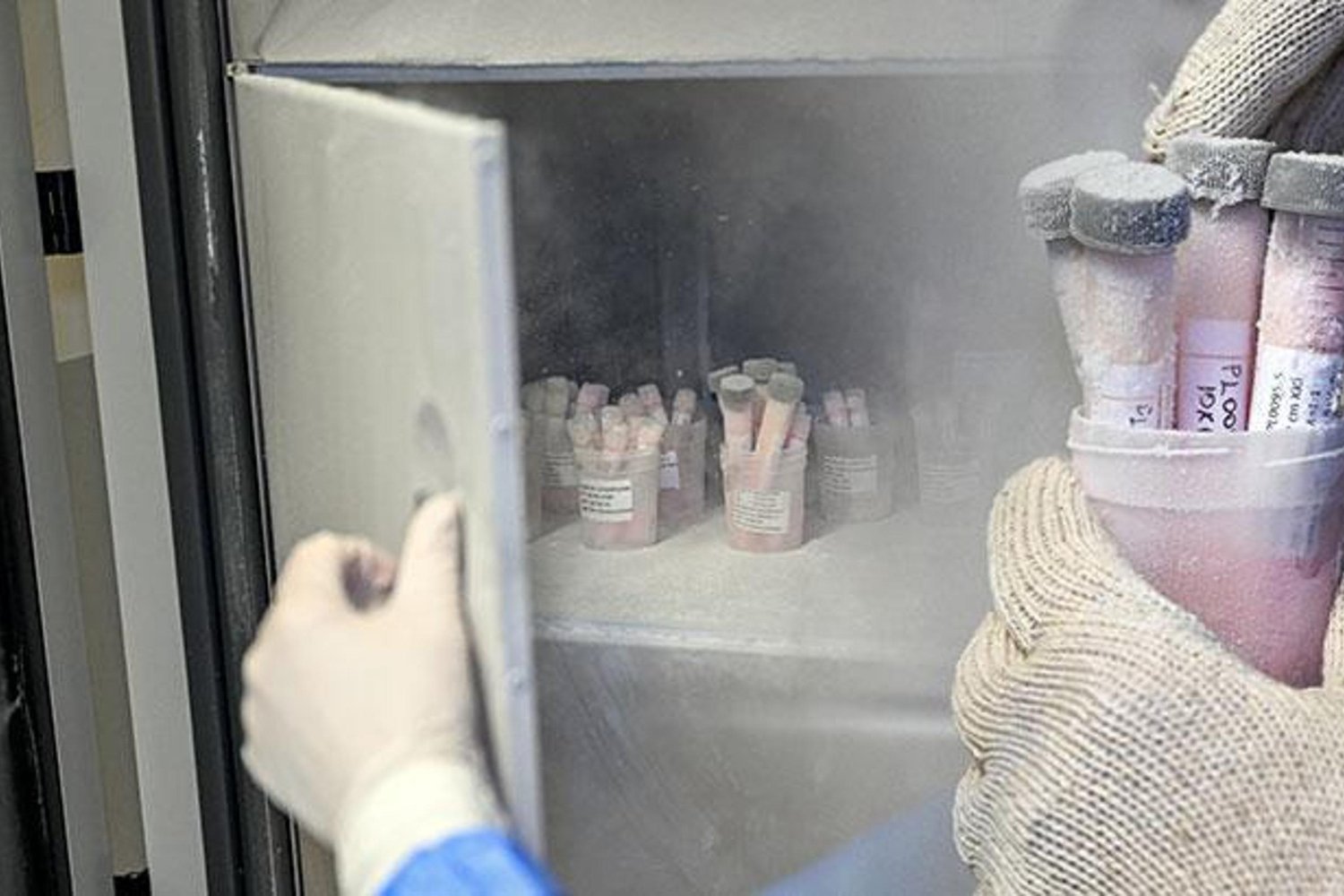 Deri Bankası ve Doku Laboratuvarı Türkiye'yi Şaşırtacak Gelişmelerle Yanık Tedavisinde Çığır Açıyor