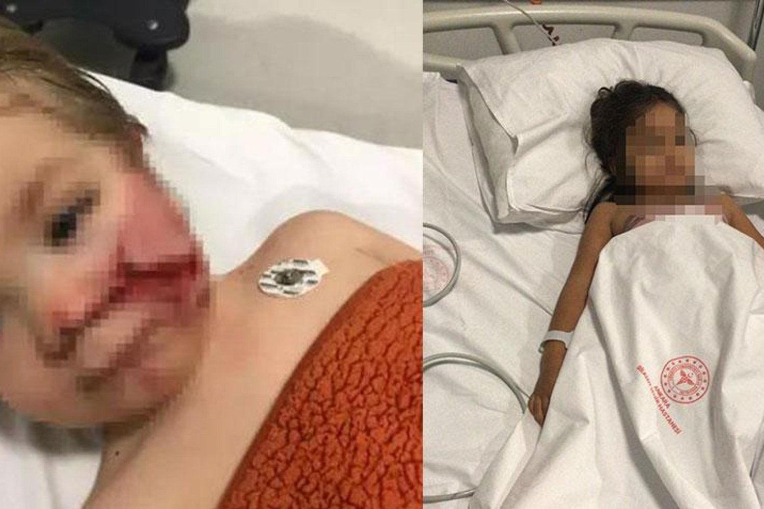 Köpek Saldırısı: Çocuklar Ağır Yaralandı, Mahkeme Duruşması Ertelendi