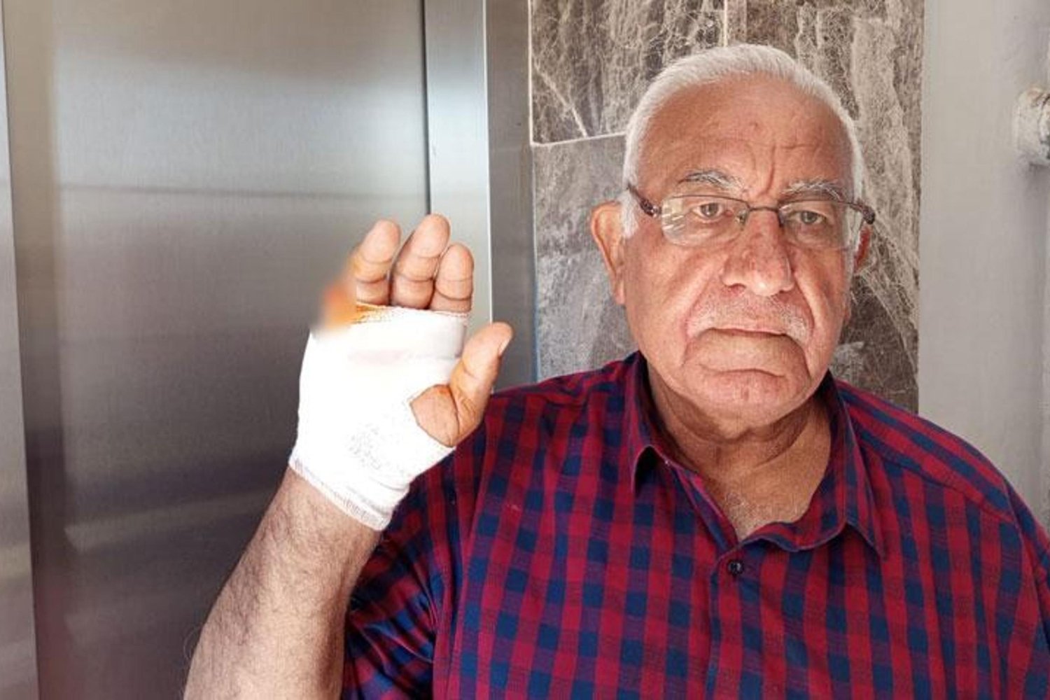 Korkutan Asansör Saldırısı: Komşu İsmail Bozdağ'ın Parmağı Koparıldı