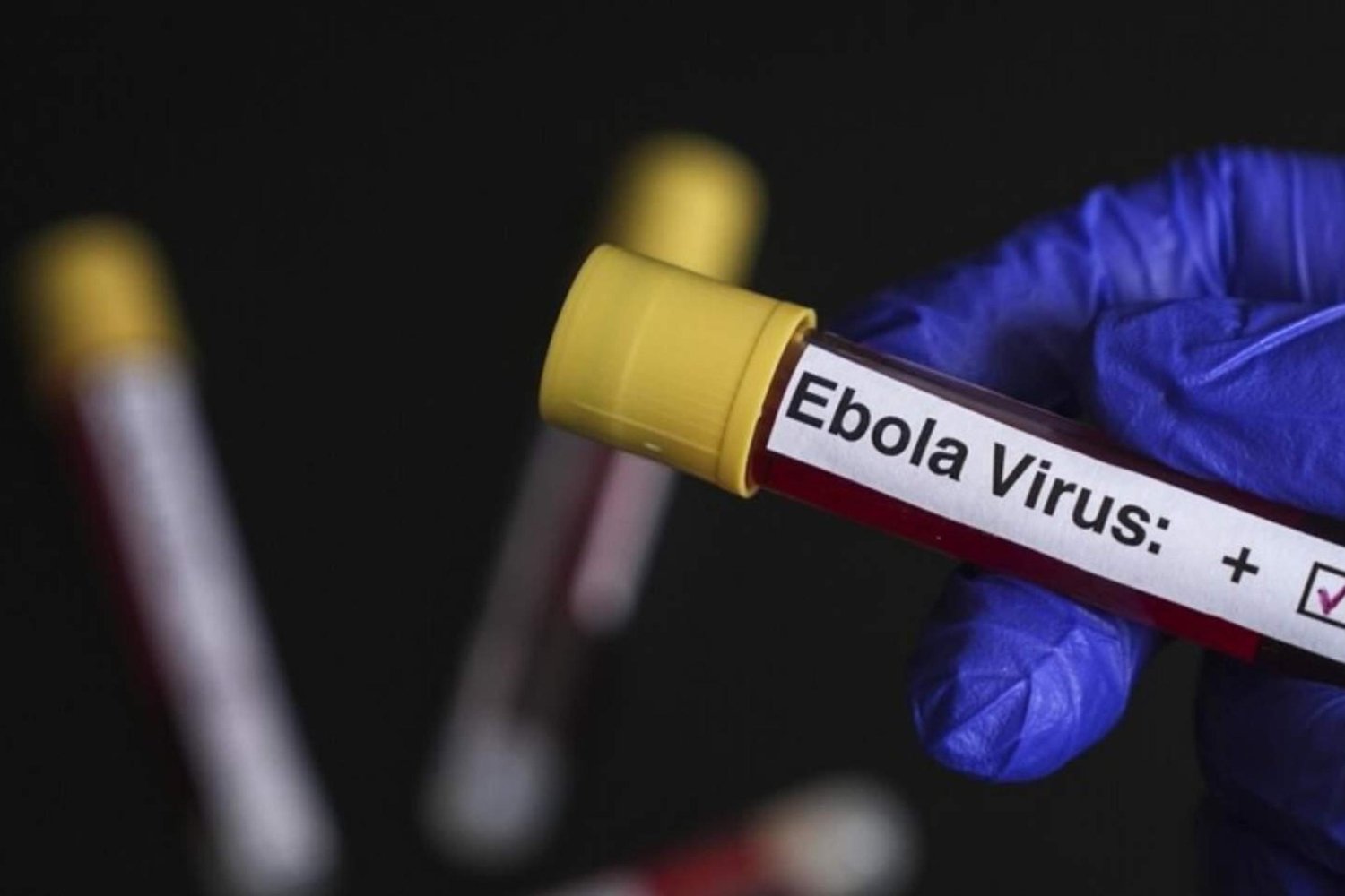 Belçika Ebola Alarmında! Ülkede Vaka Yok Ama Önlemler Sıkılaştırıldı