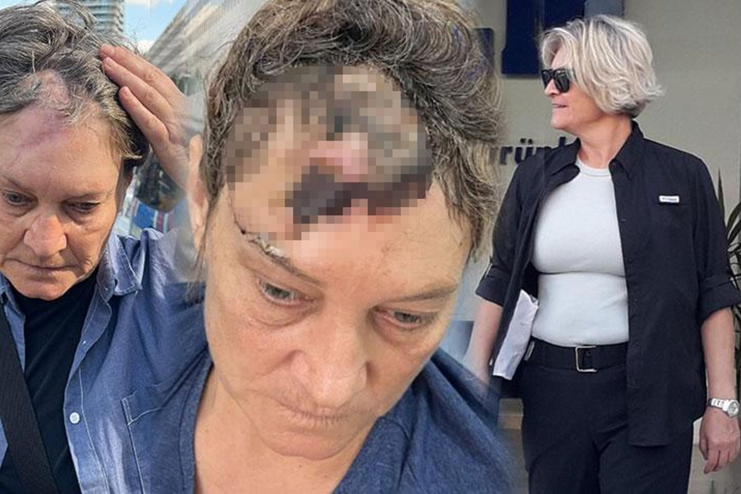 İzmir'de Köpek Saldırısı Sonrası Büyük Skandal: İş Adamının Çalışanı Ağır Yaralandı