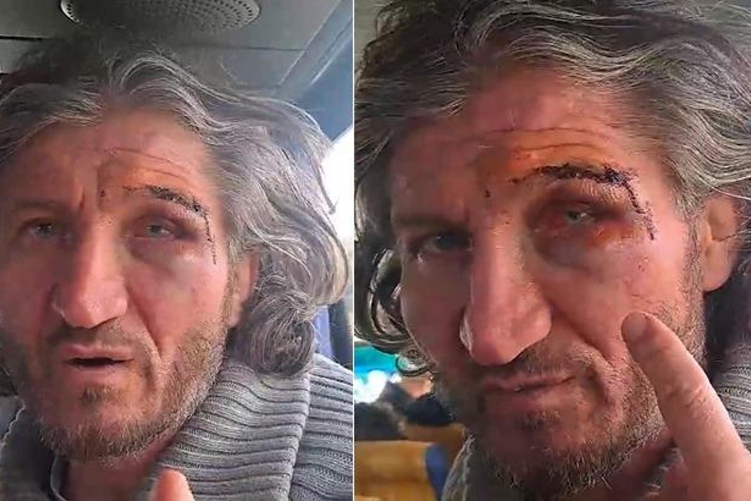 İsrail Saldırısında Türk Vatandaşı Hüseyin Oral'a Şiddet! Güncel Gelişmeler