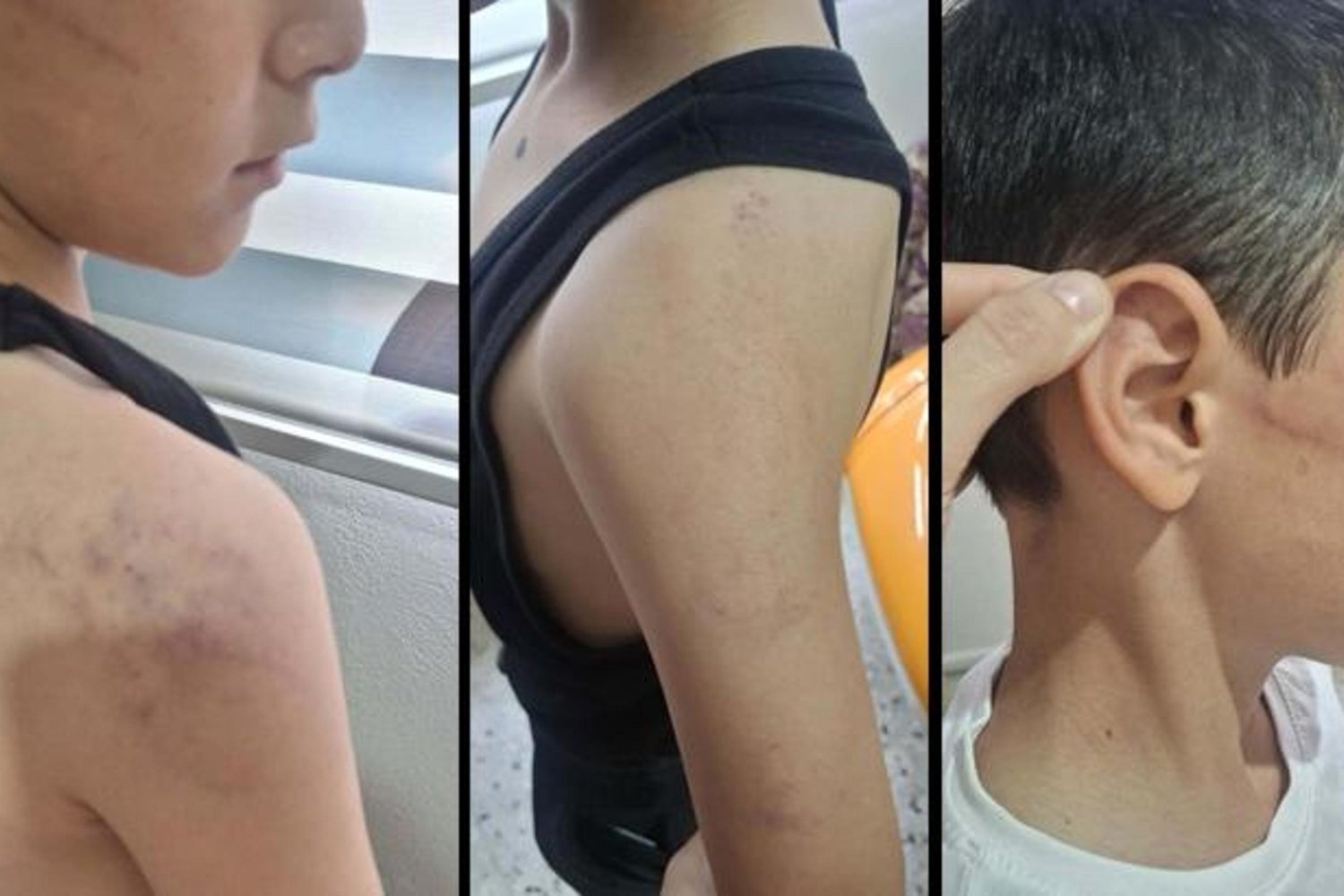 Manisa'da Çocuk Şiddeti ve Koruma Kararları: Detaylar Kongreye Dönüşüyor