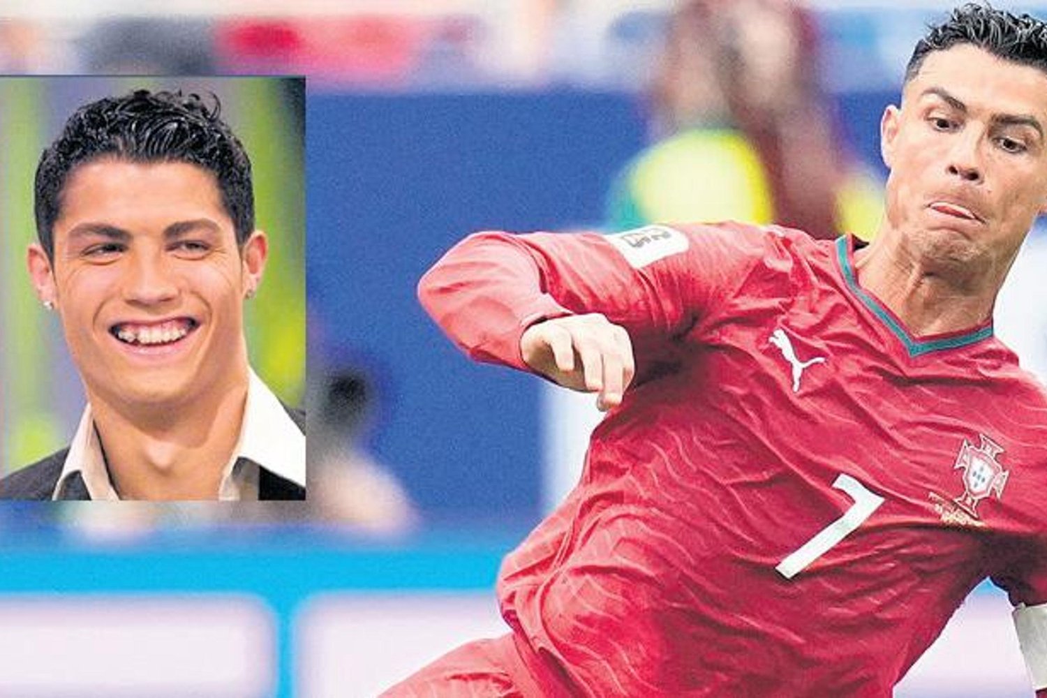 Dünya Kupası Yıldızları Estetikle Göz Kamaştırıyor: Ronaldo, Messi, Neymar ve Daha Fazlası