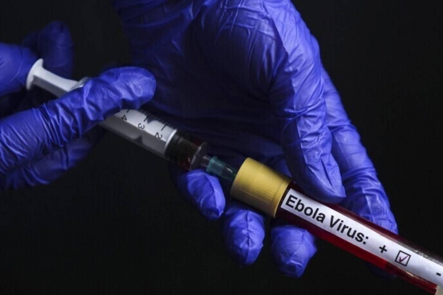 Fransa Ebola Alarmı: Doktorun Durumu ve Salgın Gelişmeleri