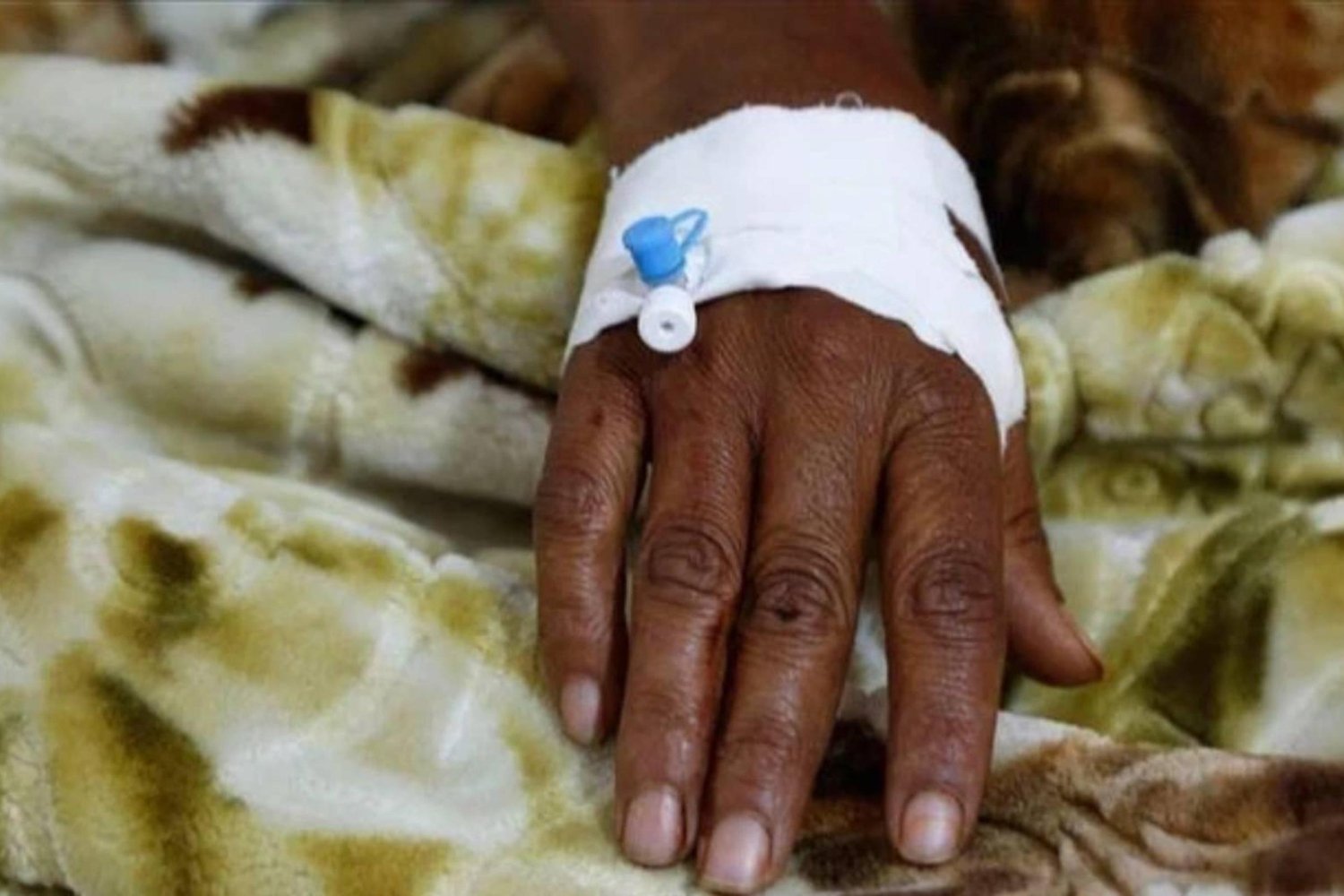 Nijerya Lassa Ateşi Salgını Artışta: 109 Bölge Etkilendi