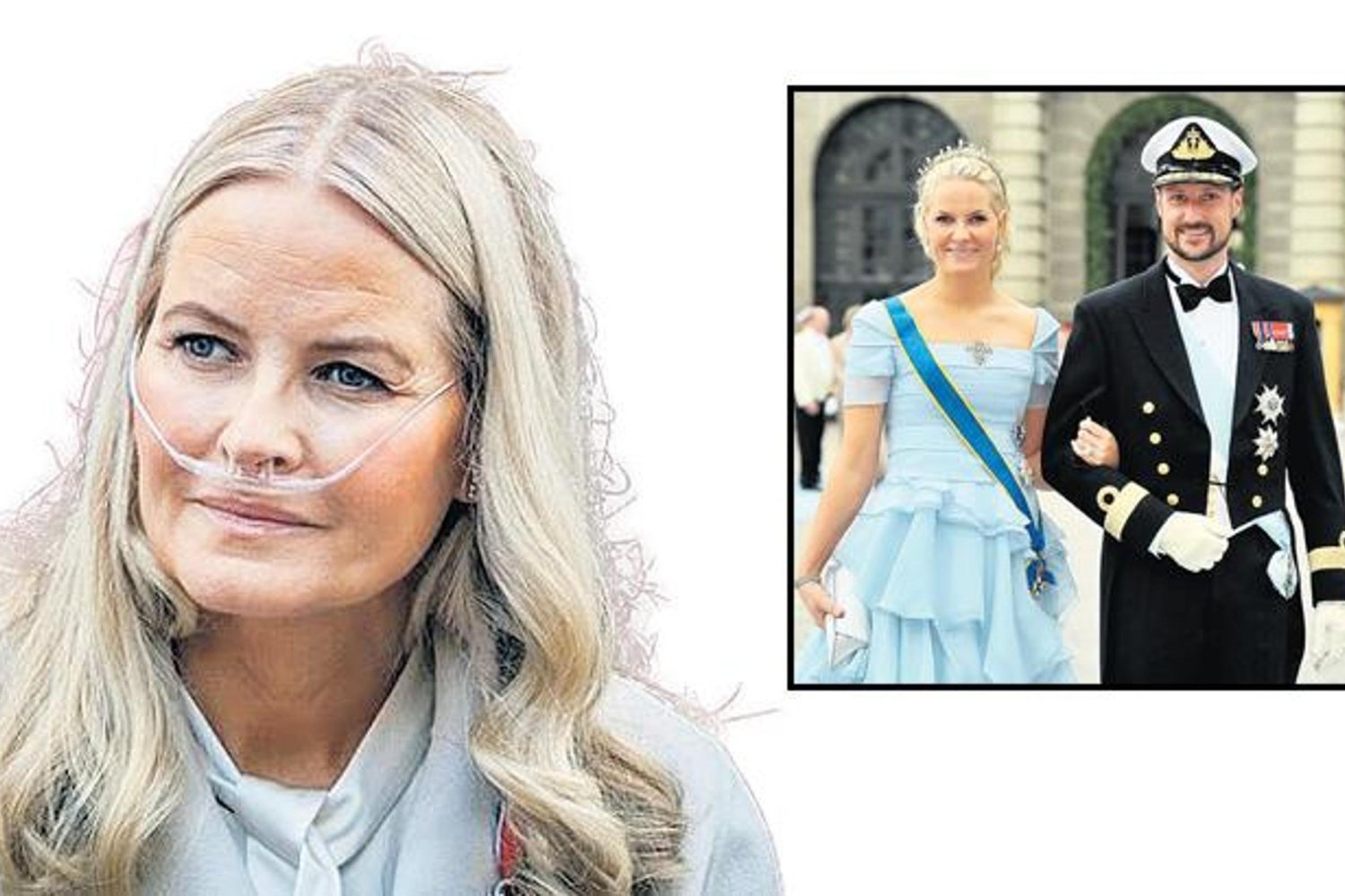 Norveç Veliahd Prensesi Mette-Marit Akciğer Nakli İçin Sıraya Girdi!